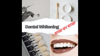 All you need to know about teeth whitening in the dental office [upl. by Notfa111]