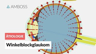 Akutes Winkelblockglaukom bei Pupillarblock  AMBOSS Video [upl. by Vinia447]