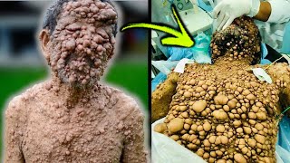 The Most Unusual People With Bizarre Skin Conditions [upl. by Nuavahs]