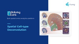 BioTuring Lens Spatial Deconvolution on Visium Data [upl. by Akayas]