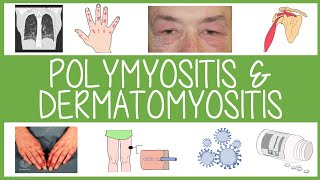 Polymyositis and Dermatomyositis in 3 Minutes [upl. by Edrahs]