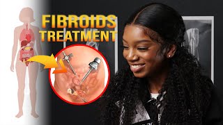 Treatment Options For Uterine Fibroids  MarieCatherine Kodjo [upl. by Reibaj]