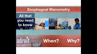 Esophageal Manometry Know when and why it is needed  Ahmedabad Gujarat INDIA [upl. by Epillihp509]