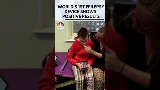 UK Teenager Gets World first epilepsy deviceIn Skull  N18G  CNBC TV18 [upl. by Bashemath770]