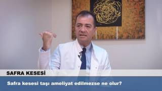 Safra kesesi taşı ameliyat edilmezse ne olur [upl. by Domel681]