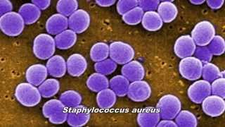 Bacteriën  Bacteria  Group A Streptococcus GAS [upl. by Vincents]