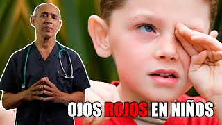 🛑 Mi niño tiene los OJOS ROJOS ✔️ ¿Qué debo hacer Cómo saber si es CONJUNTIVITIS 👈 [upl. by Bez944]