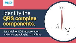 Identifying components of the QRS complex [upl. by Hephzipah446]