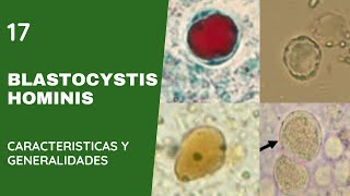 Blastocystis Hominis 17  Blastocistosis  Apicomplexas [upl. by Thelma]