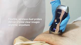 UprobeC  Viatom Double Head Ultrasound Redefined Precision Anywhere [upl. by Nylanaj]