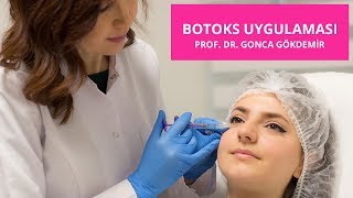 Alın kırışıklıkları için botoks uygulaması  Prof Dr Gonca Gökdemir [upl. by Sokin10]