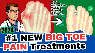 1 Big Toe Joint Pain Cure Arthritis Sesamoiditis Turf Toe Gout [upl. by Earesed278]