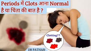 Periods में Clots आना Normal है या चिंता की बात है l Periods में खून के थक्के आने के कारण और इलाज l [upl. by Olen]