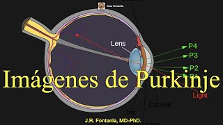 Imágenes de Purkinje Imágenes de PurkinjeSanson [upl. by Elleina126]