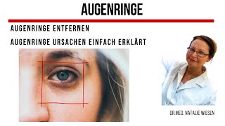 Augenringe ist Ihr Problem Augenringe Ursachen  erklärt von Drmed Natalie Wiesen [upl. by Bari233]