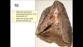 OSPE in anatomy of the respiratory system [upl. by Buskus291]