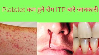 थायरोइड What Is Thyroid In Nepali Thyroid Causes Symptoms and solutions II By Yogi Prem [upl. by Nolyarg]