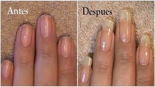 Cuanto Crecen Las Uñas en 3 Meses [upl. by Sad]