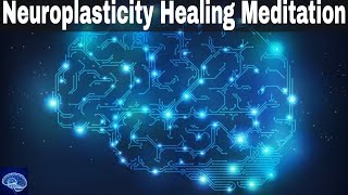 Neuroplasticity Meditation  Rebuild Your Brain  Brain Healing Sounds  Healing Frequency IV13 [upl. by Ognimod]