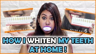 Testing TEETH WHITENING kit😱 Do they REALLY work MOLARBEAR Kit [upl. by Anaud]