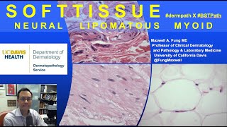 DERMATOPATHOLOGY Soft Tissue Tumors Neural Lipomatous Myoid [upl. by Dominik]