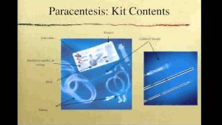 OSCE Paracentesis [upl. by Ardnaeed522]