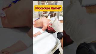 Procedure Name Human trachea ytshorts medical youtubeshorts nursing intubation hospital [upl. by Fanchan102]