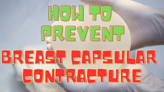 How To Prevent Breast Implant Capsular Contracture after Breast Augmentation [upl. by Llenet764]