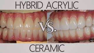 Whats the difference between acrylic and ceramic  Patients Ask [upl. by Asit]