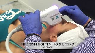 HIFU Non Invasive Skin Tightening Gold Coast Australia [upl. by Adamik]