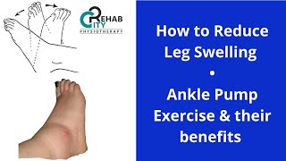 How to reduce leg swelling  ankle pump exercises  ankle swelling  lower leg swelling [upl. by Trevethick]