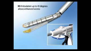 Endo GIA™ Curved Tip Reloads with Tri Staple™ Technology YouTube [upl. by Backler]