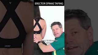 Taping The Erector Spinae [upl. by Jacquenetta]