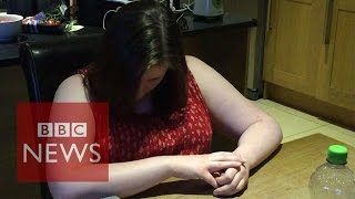 Narcolepsy What is it like to have a cataplexy attack  BBC News [upl. by Eecart209]