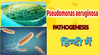 Pseudomonas aeruginosa pathogenesis lab diagnosis amp treatment  microbiology in hindi [upl. by Aicirtam]