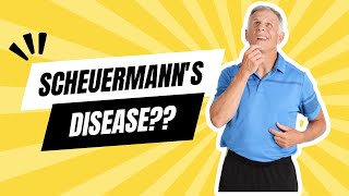 What is Scheuermanns Disease [upl. by Jolee30]