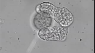 Entamoeba histolytica trophozoites [upl. by Lepper]