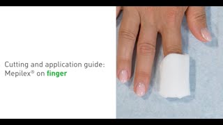 How to apply Mepilex on a finger [upl. by Luanne450]