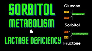 USMLE Step 1  Lesson 61  Sorbitol Metabolism and Lactase deficiency [upl. by Helas]