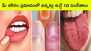 Top 10 signs your body asking for help  signs your body is in danger  Telugu facts  BMC Facts [upl. by Aicemat681]