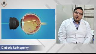 Diabetic retinopathy l ਡਾਇਬੀਟਿਕ ਰੈਟੀਨੋਪੈਥੀ l मधुमेह संबंधी रेटिनोपैथी [upl. by Jaynes847]