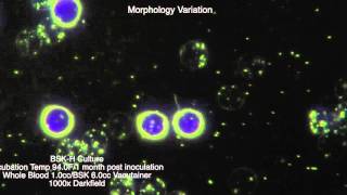 Spirochete Morphology [upl. by Nesta]