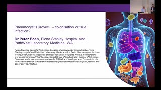 Pneumocystis jirovecii – colonisation or true infection Dr Peter Boan [upl. by Releyks338]