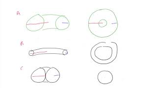 28 Introduction to Toric Lenses [upl. by Phelips114]