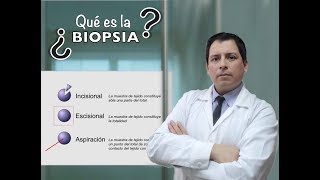 ¿QUÉ ES UNA BIOPSIA❓Lo que debemos saber ❗ [upl. by Nedyarb]