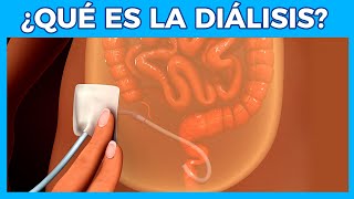 DIALISIS PERITONEAL 💊 Que es la dialisis  Junica IRC [upl. by Rondon51]