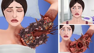 ASMR Remove leeches amp Ticks from infected girl armpit  ASMR Animation Treatment restasmr1 [upl. by Remmus385]