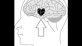 ¿Como desenamorarse de cualquier persona La ciencia del desamor comprobada [upl. by Richey212]