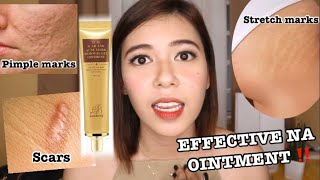 EFFECTIVE NA OINTMENT ‼️PIMPLE MARKS  SCARS  STRETCH MARKS  Lai Cruz [upl. by Nemrac]