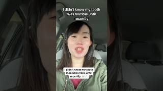 Why This Girl Was BULLIED For Her Teeth 😬🦷 [upl. by Akinnej312]